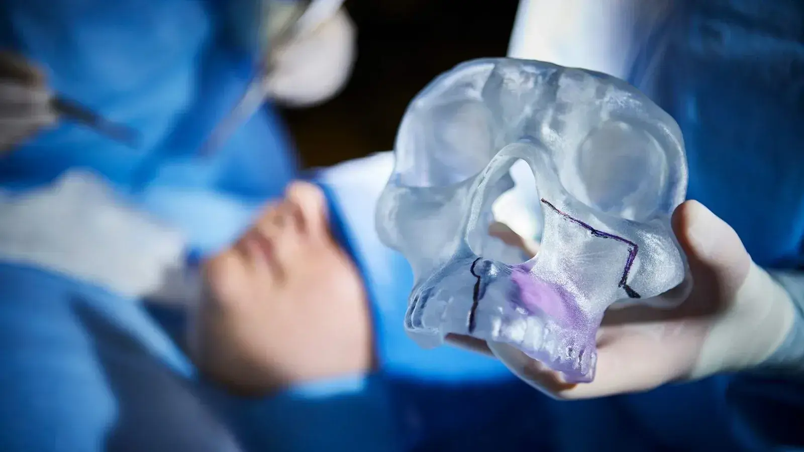 A three dimensional printed skull.