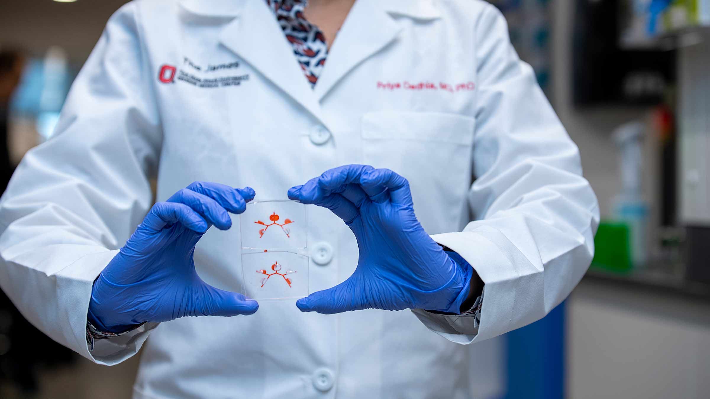 A researcher wearing gloves holds up a sample "metastasis-on-a-chip."